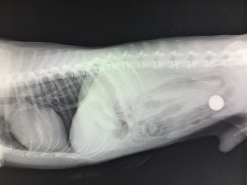 腸閉塞