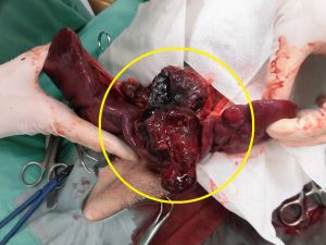 脾臓腫瘍の摘出手術