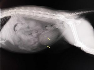 膀胱結石の摘出手術