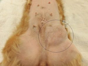 鼠径ヘルニアの手術