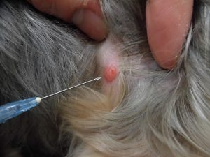 体にしこりを見つけたらー細胞診検査ー