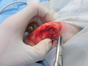 猫の前十字靱帯断裂～整復手術