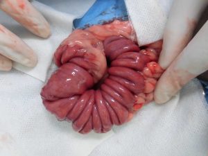 消化管内異物の緊急手術