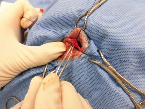 犬の直腸腫瘍摘出手術