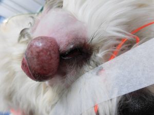 顔の皮膚腫瘍摘出手術