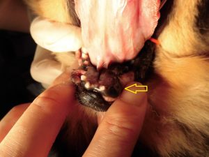 歯原性嚢胞の摘出手術