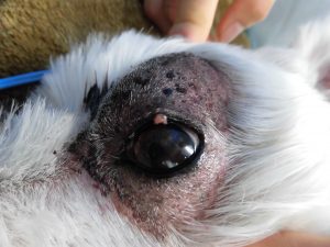 眼瞼腫瘍（マイボーム腺腫）の切除手術