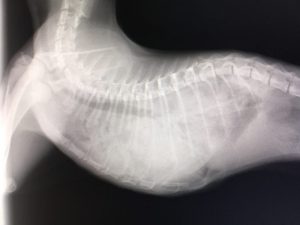 外傷性横隔膜ヘルニアの整復手術