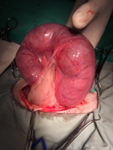 夜間の緊急手術