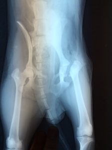 大腿骨頭切除術