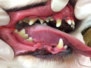 歯周病について