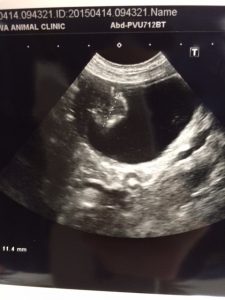 膀胱腫瘍の手術