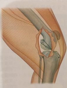 膝蓋骨内方脱臼+前十字靭帯断裂の手術
