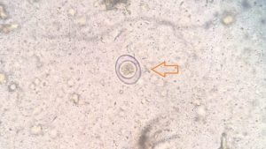 消化管内寄生虫「コクシジウム」