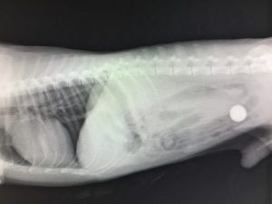 消化管内異物の緊急手術